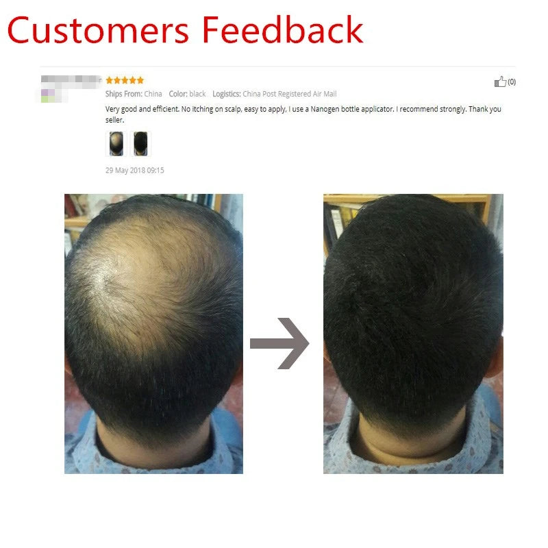 Sevich Refill 100g Hair Fiber Hair Loss Products Hair Building Fibers Powders Thicken Thin Hair 10 Colors Keratin Hair Regrowth