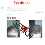 Sevich Hair Fiber Refill 100g Hair Loss Products Keratin Thickening Spray Hair Building Fibers Powders Keratin Hair Regrowth