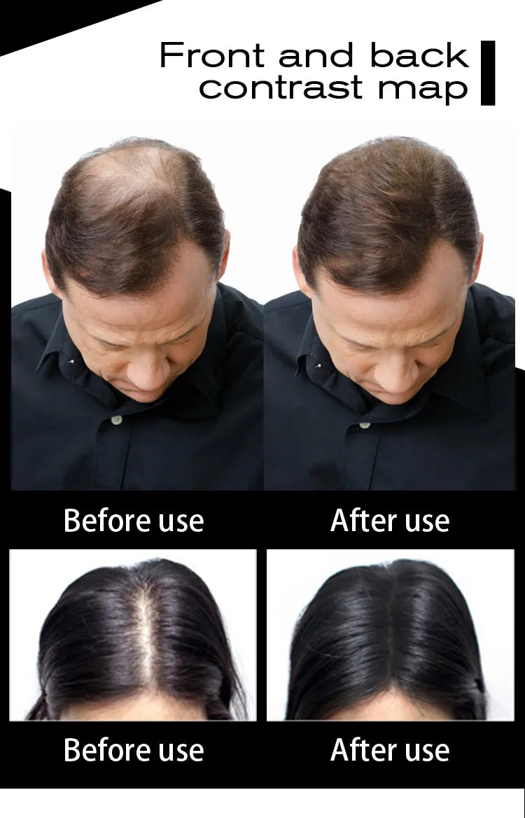 Sevich Hair Fiber Refill 100g Hair Loss Products Keratin Thickening Spray Hair Building Fibers Powders Keratin Hair Regrowth