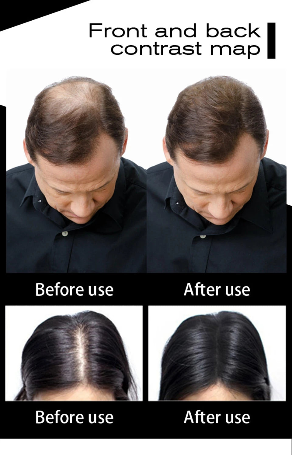 Sevich Refill 100g Hair Fiber Hair Loss Products Hair Building Fibers Powders Thicken Thin Hair 10 Colors Keratin Hair Regrowth