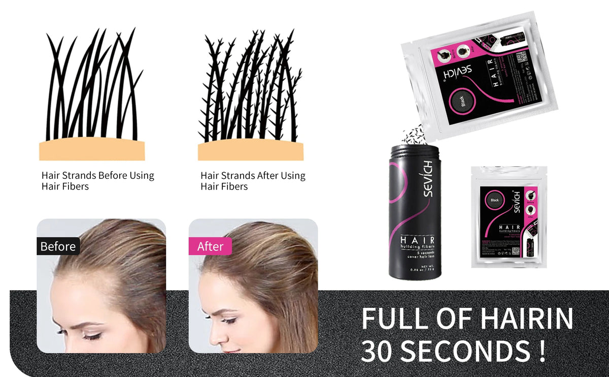 Sevich Hair Building Fibers For Men & Women Dark Brown 25g Fill In Fine Or Thinning Hair Instantly Thicker Fuller Looking Hair